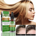 Rose Essential Oil For Hair Growth Store