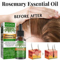 Rose Essential Oil For Hair Growth Store