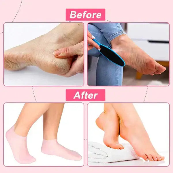 Silicone Socks ST TREND ZONE
